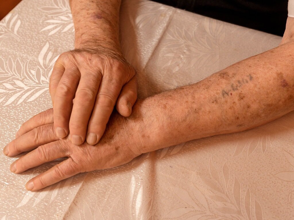 Mr. Matyash’s Auschwitz prisoner number, A-6307, was tattooed on his left arm when he arrived at the concentration camp in 1944. He was 13.Credit...Sasha Maslov for The New York Times