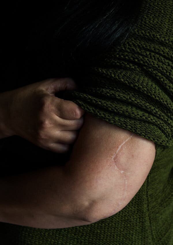 Ms. Helfer’s abusive relationship with her husband culminated one morning in July 2014, when he stabbed her more than a dozen times. She can still count the scars.Credit Alex Flynn for The New York Times